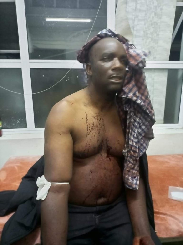 Bad Blood in DPP sees Mchacha hacked by unknown hitmen