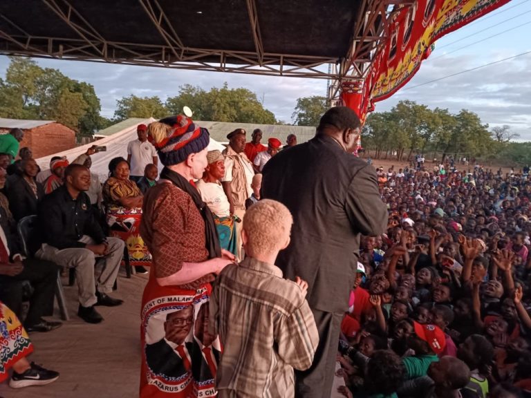 Zikhale assured total security of people with albinism