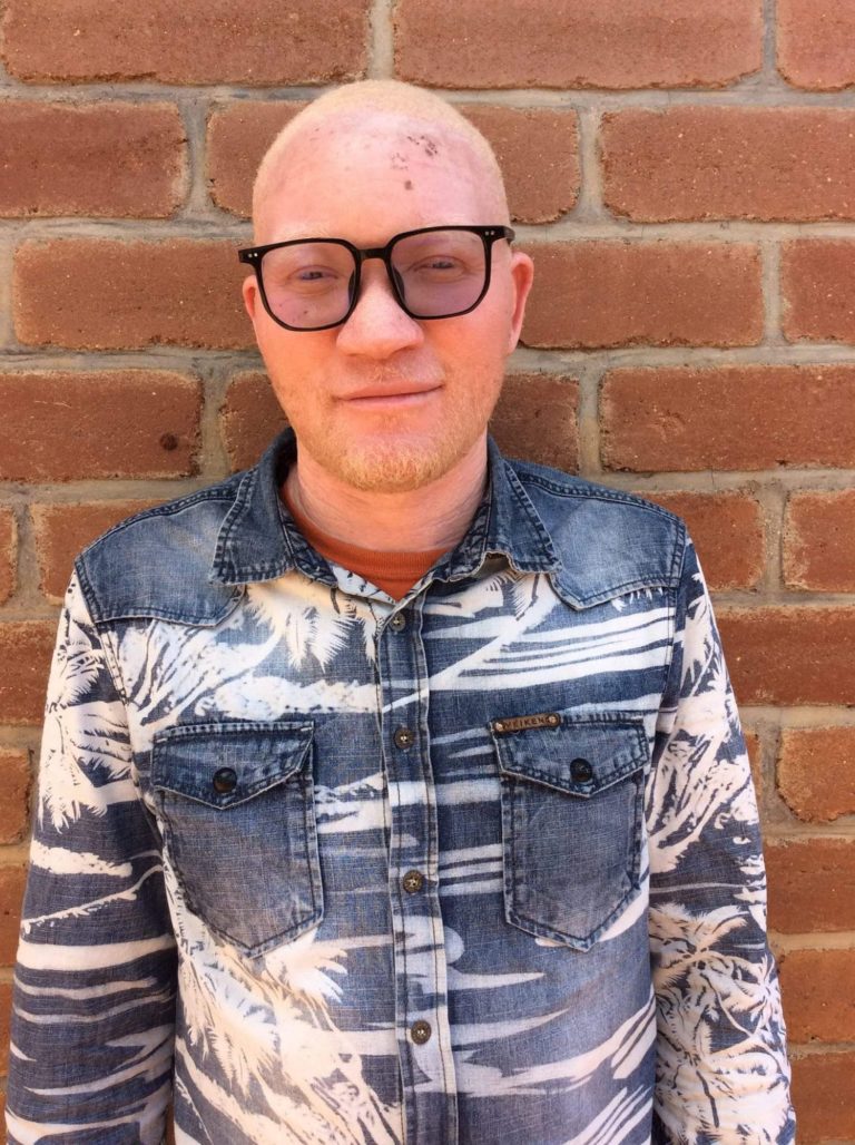 Parents of children with albinism call for wider awareness on child rights