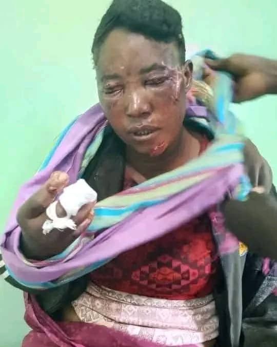 Couple in Pemba hospitalized after violent domestic fight, both face criminal charges